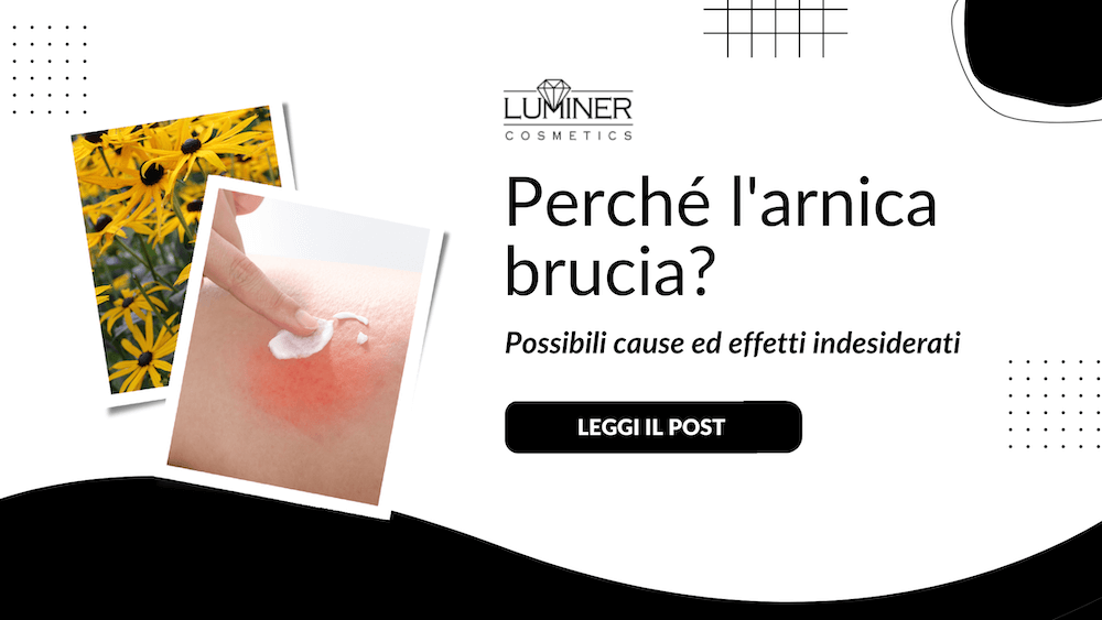 Perché l'arnica brucia? Cause, rimedi, approfondimenti